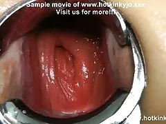 Anal